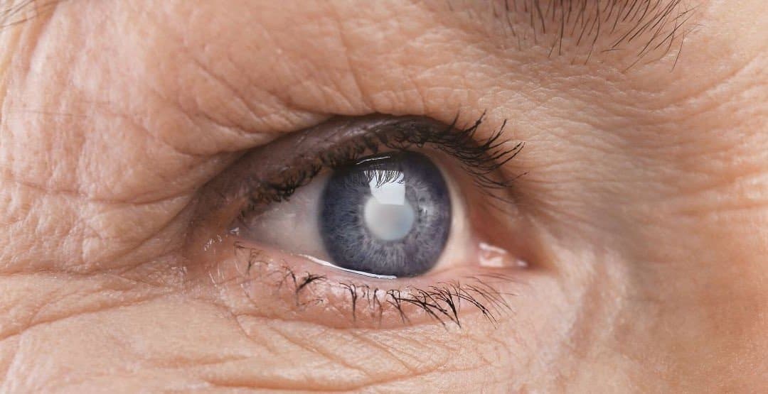 Inteligência artificial do Google detecta retinopatia diabética e edema macular