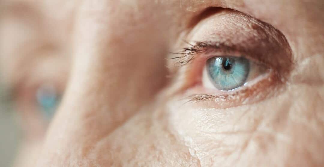 O que é glaucoma? Quase metade dos brasileiros não conhece a doença