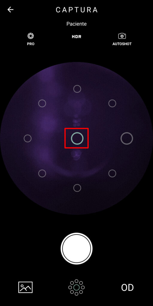 Faq Como Realizar Captura Com Macula No Centro Da Foto 1