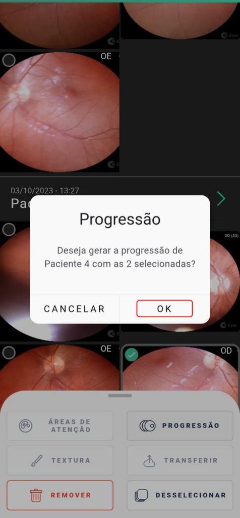 Help Progressao1