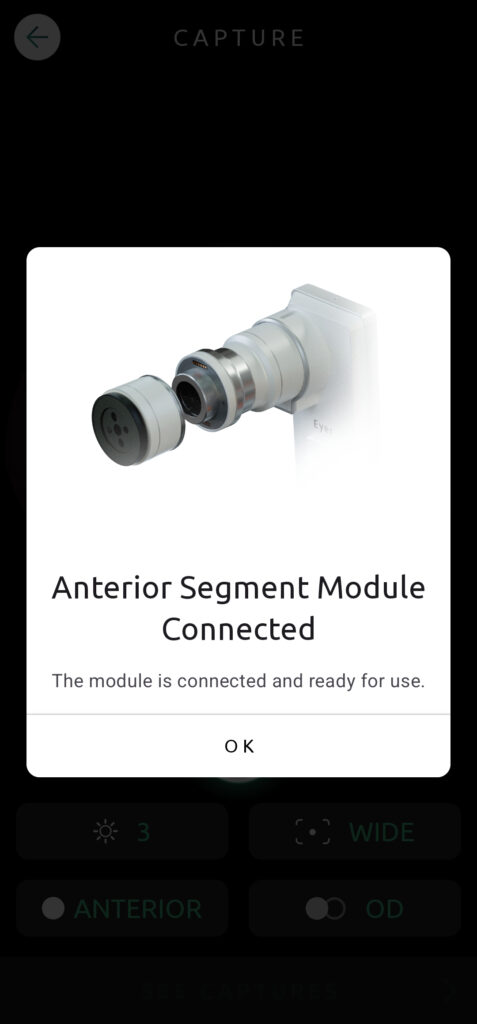 Help Capture Screen Anterior Segment 01