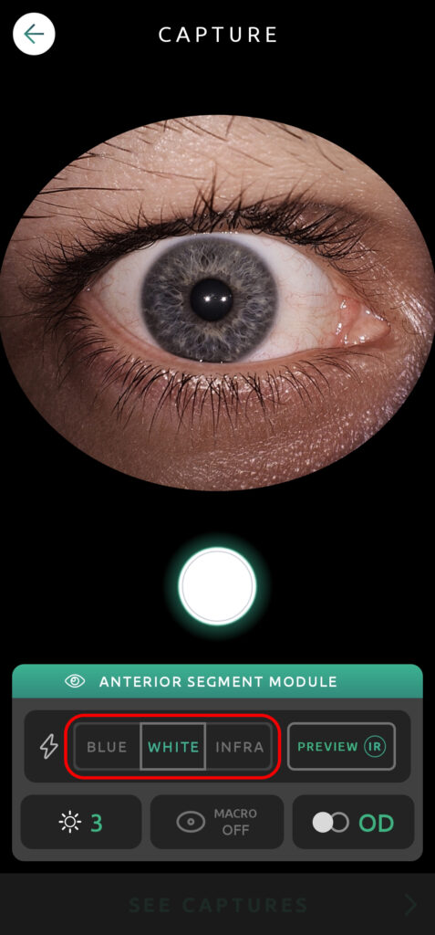 Help Capture Screen Anterior Segment 03