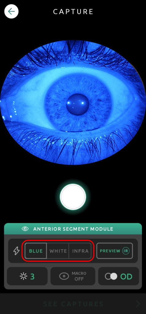 Help Capture Screen Anterior Segment 04