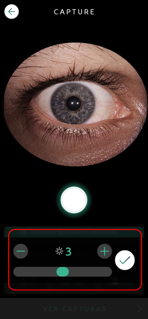 Help Capture Screen Anterior Segment 07