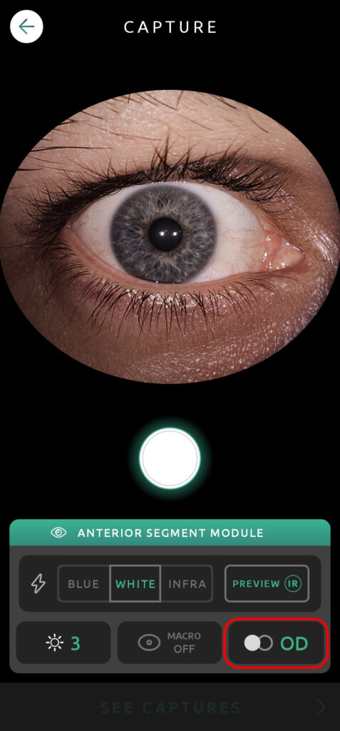 Help Capture Screen Anterior Segment 08