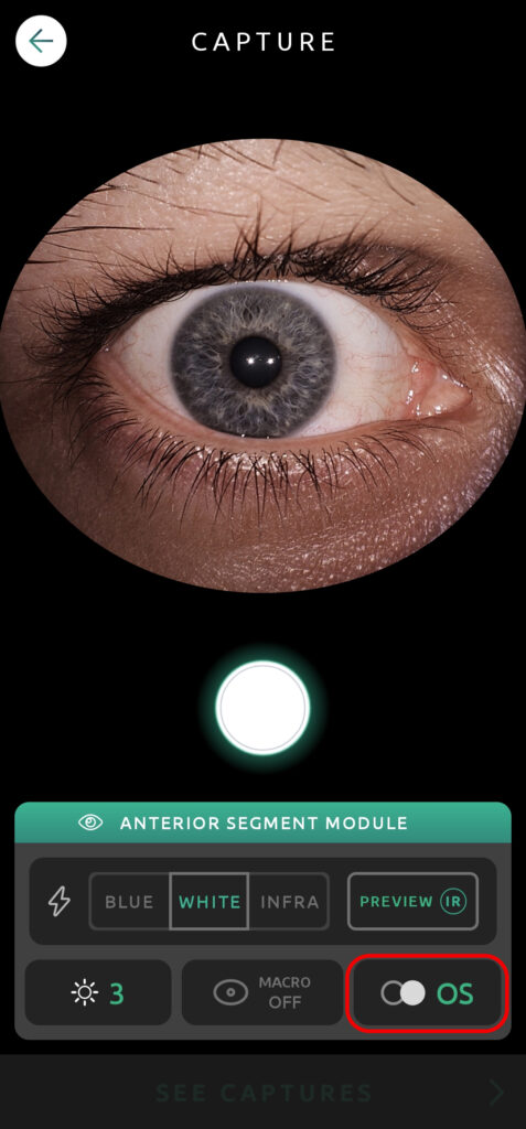 Help Capture Screen Anterior Segment 09 1