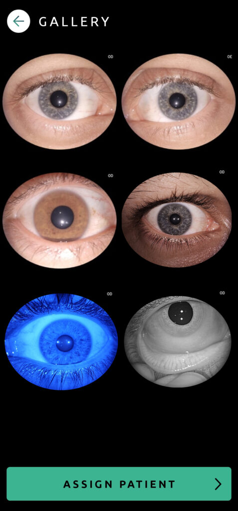 Help Capture Screen Anterior Segment 12