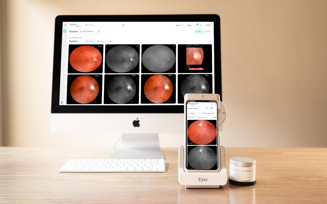EyerCloud: a nova era na gestão de exames oftalmológicos